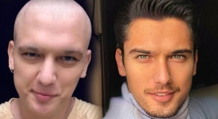 Kanserle mücadele eden Boğaç Aksoy: İnşallah setlere geri döneceğim - magazin