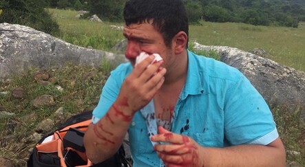 Saldırıya uğrayan muhabir dehşeti anlattı - gundem