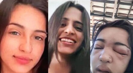 Kaşını delen genç kız kalp krizinden öldü - yasam