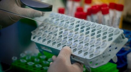 Genetik araştırma merkezinde hırsızlık skandalı - yasam