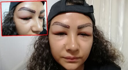 Reklam yüzü olmak için gitti, yüzünden oldu - dunya