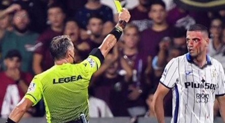 Kanlar içinde yerde kalan Merih Demiral sosyal medyadan ateş püskürdü! - spor