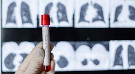 29 Ekim koronavirüs vaka tablosu açıklandı - dunya