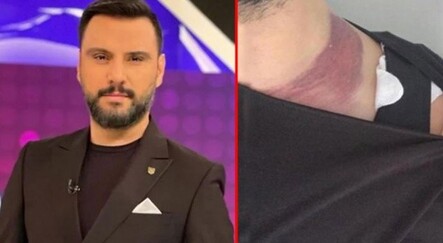 Ameliyatta ölümden dönen Alişan’dan doktoruna 2 milyonluk tazminat davası - magazin