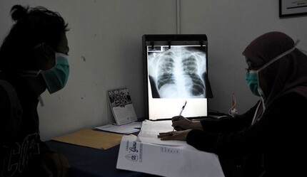 Covid-19 veremden ölümleri artırdı - saglik