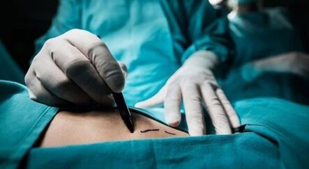 Estetik operasyonu geçirirken kalbi durdu! 4 yıldır bitkisel hayatta - dunya