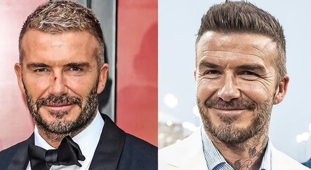 Hayranların gözünden kaçmadı: David Beckham botoks yaptırdı iddiası - yasam