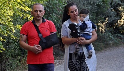 Yine pitbull dehşeti! Babayla 11 aylık oğlunu parçaladı - dunya