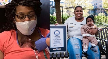 21 haftalıkken doğdu Guinness Rekorlar Kitabı'na girdi - dunya