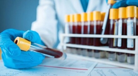 ABD yayınladı: Kan testi ile kanser tespit edilebilir - saglik