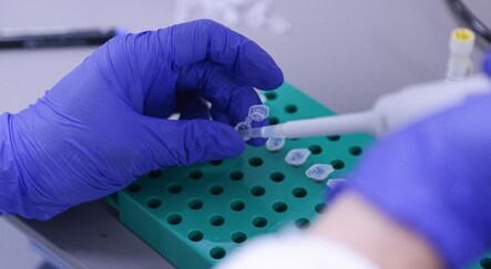 Bakan Varank: Sağlık Bakanlığı acil kullanım onayı verecek - turkiye