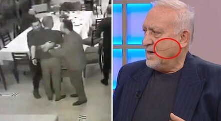 Cengiz Kurtoğlu'nun bıçaklı saldırısına uğrayan iş adamından açıklama geldi! - yasam
