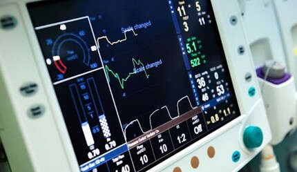 Çip krizi sağlığı vurdu, gecikmeler 1 yılı buluyor - teknoloji