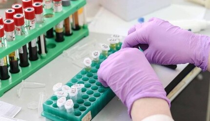 Bakan Koca duyurdu: Aile hekimliklerinde SMA taraması başladı - ekonomi
