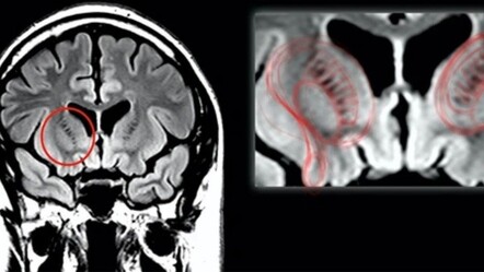 Çarpıcı bulgular: UFO gördüğünü söyleyen pilotların beynini inceledi - teknoloji