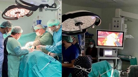 Kanser hastasına mideden yemek borusu yaptılar - saglik