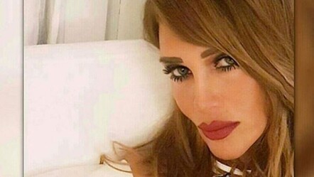 Seren Serengil'den kötü haber! Organları iflas etmek üzere | Dumping sendromu (zayıflama hastalığı) nedir? - saglik
