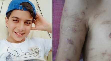 Sokak köpekleri 10 yaşındaki çocuğun hayatını kararttı - yasam