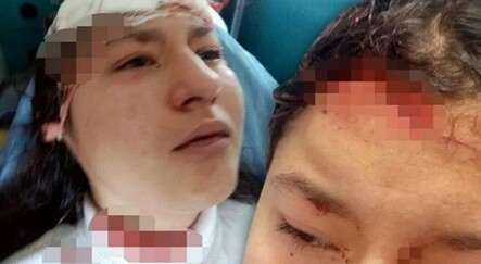 14 yaşındaki çocuk selfie çekilirken köpeklerin saldırısına uğradı - teknoloji