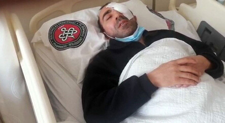 Avcılar’da trafik magandaları belediye çalışanını darp etti: Kameraman gözünü kaybetti - gundem