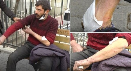 Gaziantep'te ikinci pitbull vakası - yasam