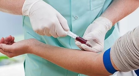 Kan tahlilinden kanser teşhisi yapılabilecek - saglik