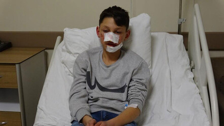 Sokakta dehşet anları! Ekmek almaya giden çocuğa köpek saldırdı - ekonomi