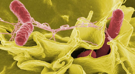 Salmonella alarmı! Vakalar arttı… Dikkat: 8-48 saat sonra belirti vermeye başlıyor - saglik