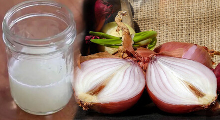 Vücudu resetliyor: Soğan kabuklarını sakın çöpe atmayın! Soğan kabuğunu kaynatıp içerseniz… - saglik