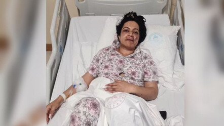 Akılalmaz olay! Eltilerin kıskançlık kavgası: Silahla ağzından vuruldu - yasam