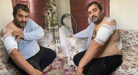 Bartın'da feci ayı saldırısı: Böbreklerimi söktü... Öldü sanınca bıraktı - dunya