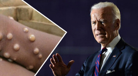 Biden'dan 'Maymun çiçeği virüsü' açıklaması: Herkes endişelenmeli - dunya