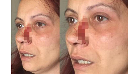 Büyükçekmece'de dehşet! Aidat ödemediği iddiasıyla kadını darp ettiler - emlak