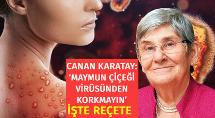 Canan Karatay’dan maymun çiçeği virüsü açıklaması: ‘Virüsten koruyor’ dediği ayrıntıya dikkat çekerek uyardı - saglik
