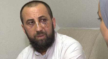 Dövüldü, eşinin başörtüsü takmasına izin verilmedi: Almanya'da polis şiddeti - yasam