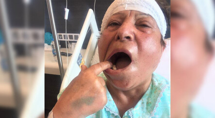 Diş ağrısı sanıp 5 sağlam dişini çektirdi, delirten hastalığı 70’inde yendi - saglik