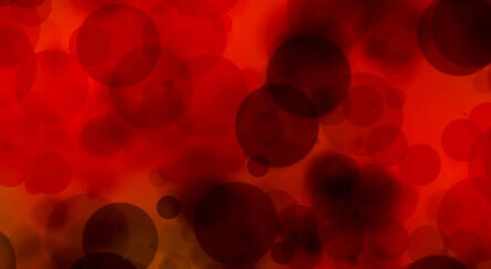 İdrarda kan görülmesi ihmale gelmez, hemen doktora başvurun - saglik