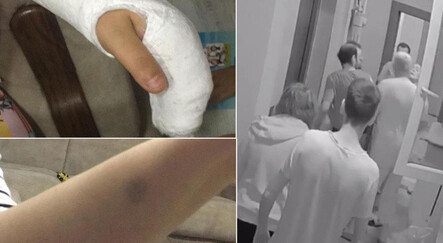 Komşu kavgasını ayırmak isterken darp edildi, hamile eşinin parmakları kırıldı - yasam