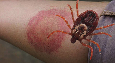 Korkutan tahmin: Dünyanın yüzde 15’i kene ısırığıyla bulaşan hastalığı taşıyor - saglik