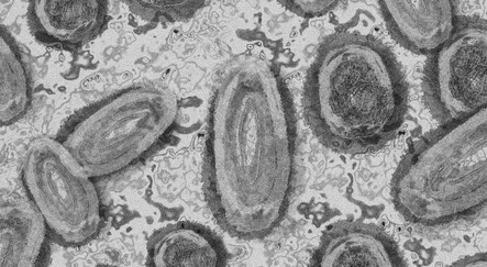 Maymun çiçeği bir ülkeye daha sıçradı: İlk vaka onaylandı - dunya