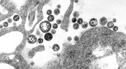 Türkiye’de 3 milyon kişide görülüyor! Endişelendiren uyarı: 1998 öncesi doğanlar test yaptırsın - saglik