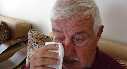 Katarakt ameliyatı için gittiği hastanede hayatının şokunu yaşadı - saglik
