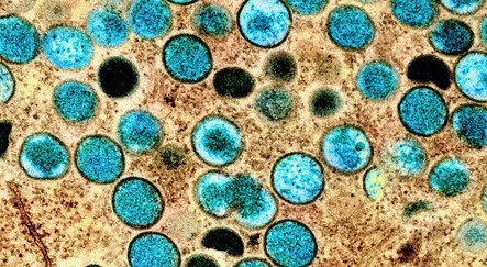 Maymun çiçeğinde can kaybı artıyor: Hindistan'da maymun çiçeği kaynaklı ilk ölüm - saglik