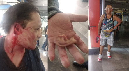 Metroda çıkan taciz kavgasında, tacizcinin kulağını kopardılar - yasam