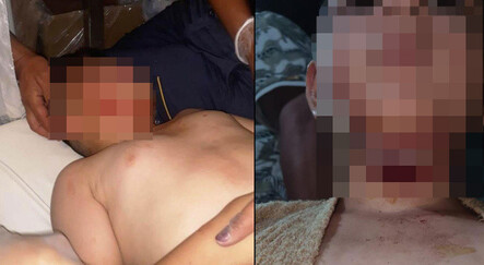 Sevmek istediği köpek dehşeti yaşattı! 9 yaşındaki çocuğa 40 dikiş atıldı - magazin